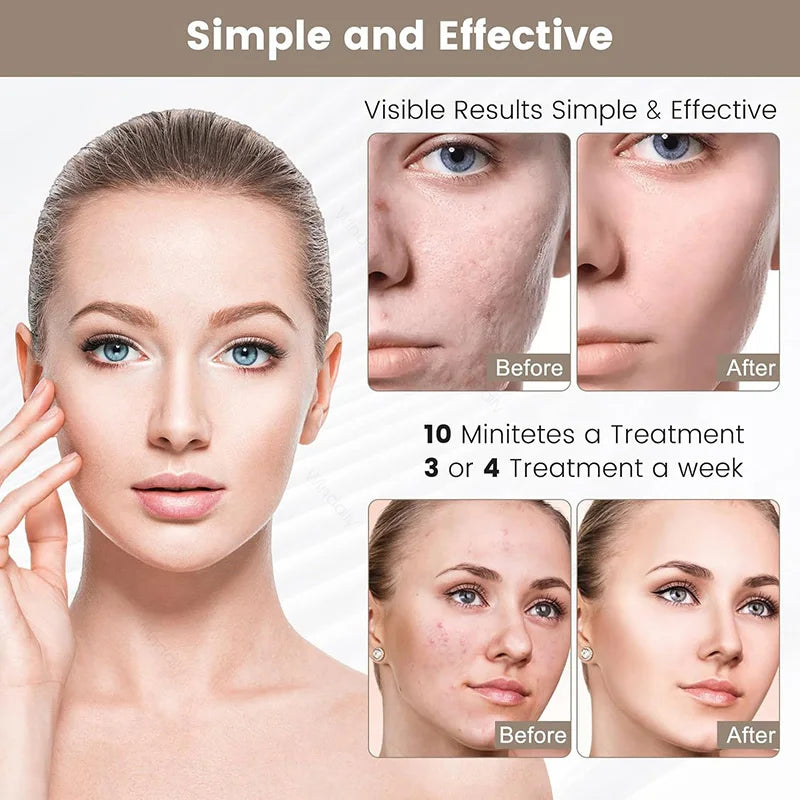 7 Colors LED Face Mask Light Therapy Rechargeable Wireless Facial Beauty Mask Anti Wrinkle Skin Tightening Skin Care Device Tool